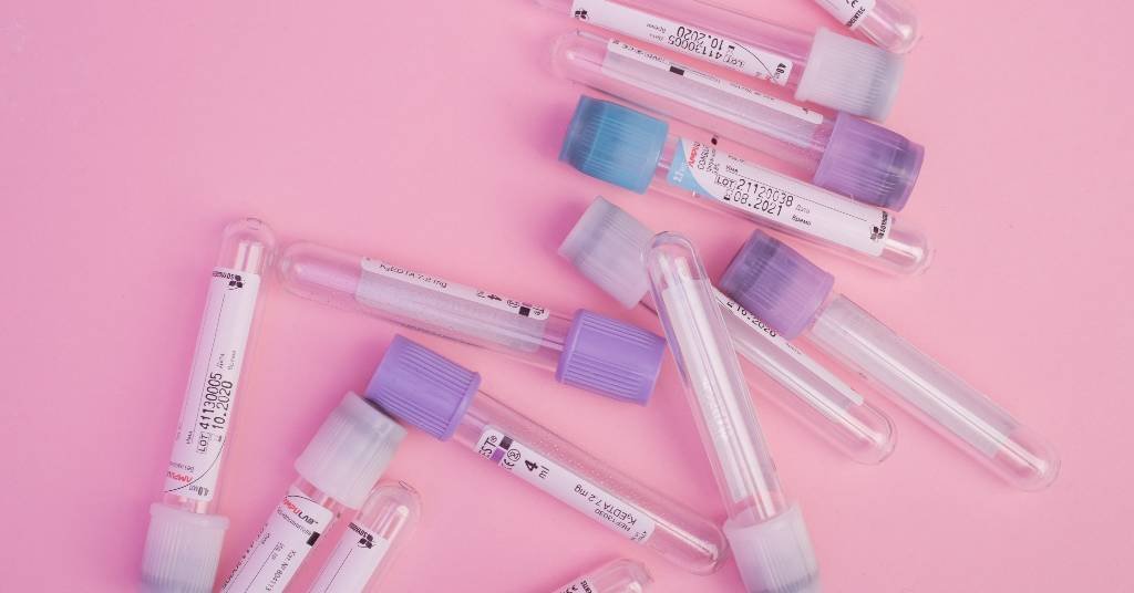 Things you need to know about Anti-Mullerian Testing (1)